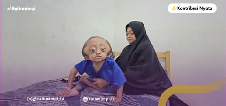 Artikel: Rafa Hadapi Penyakit Langka, Bantuan Bantu Ringankan Beban Pengobatan