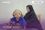 Artikel: Rafa Hadapi Penyakit Langka, Bantuan Bantu Ringankan Beban Pengobatan