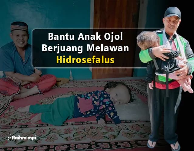 7 TAHUN KESAKITAN, Anak Driver Ojol Hidrosefalus