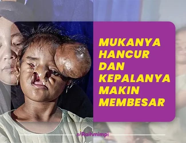 Foto campaign HARUS DI RUJUK KE LUAR NEGERI, ULURKAN BANTUAN UNTUK MAKWA BEROBAT