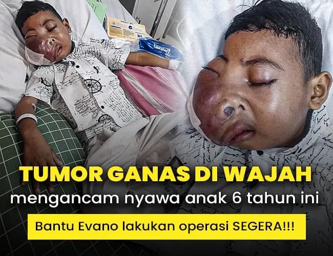 Foto campaign Kisah Pilu Evano, Anak Berusia 6 Tahun Berjuang Melawan Tumor Ganas
