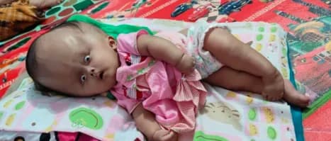 Foto campaign Ayah Pergi Putri Berjuang Lawan 2 Penyakit Ganas
