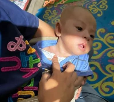 Adik Luthfi Bayi 3 Bulan komplikasi penyakit BERAT
