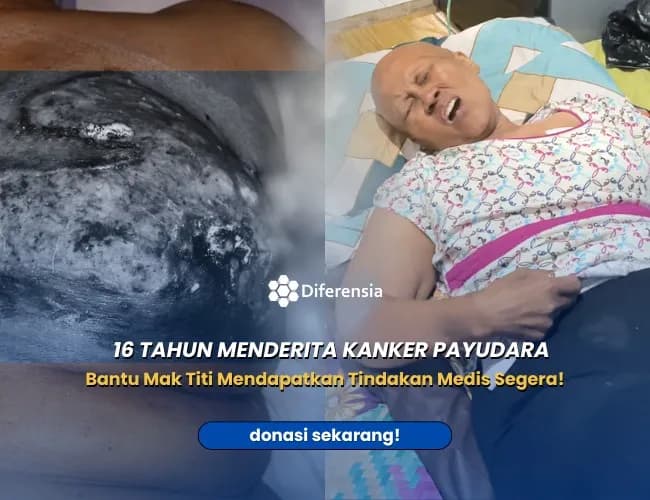 Foto campaign URGENT. KANKER MENGANCAM NYAWA MAK TITI