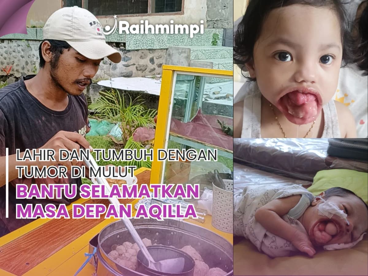 Foto campaign BANTUU, Kanker Ganas Serang Mulut Balita
