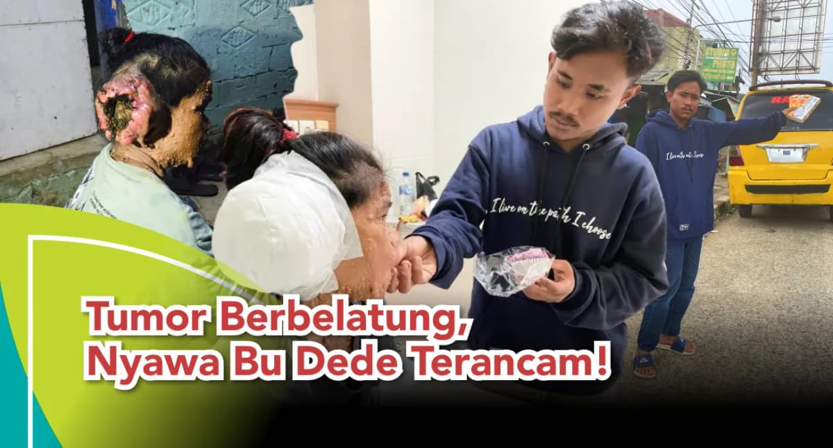 Foto campaign Tumor Berbelatung Nyawa Bu Dede Terancam
