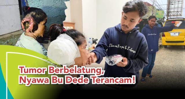 Tumor Berbelatung Nyawa Bu Dede Terancam