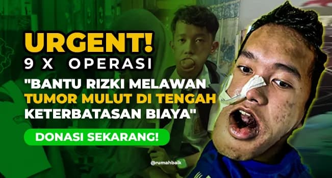 Foto campaign Anak Kuli Bangunan Ini Idap Tumor Mulut Sampai Kesulitan Berbicara