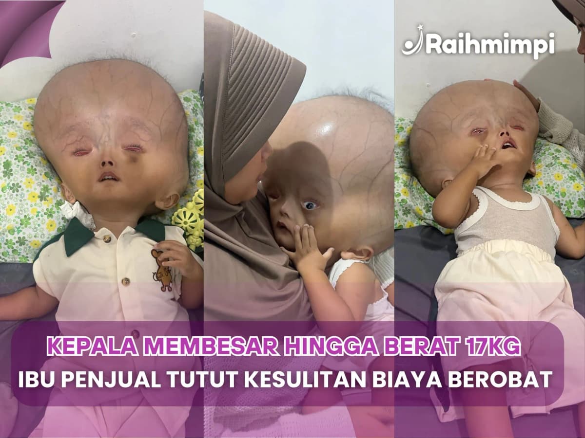 Foto campaign Kepala Terus Membesar, Bantu Nugraha Lanjutkan Pengobatan