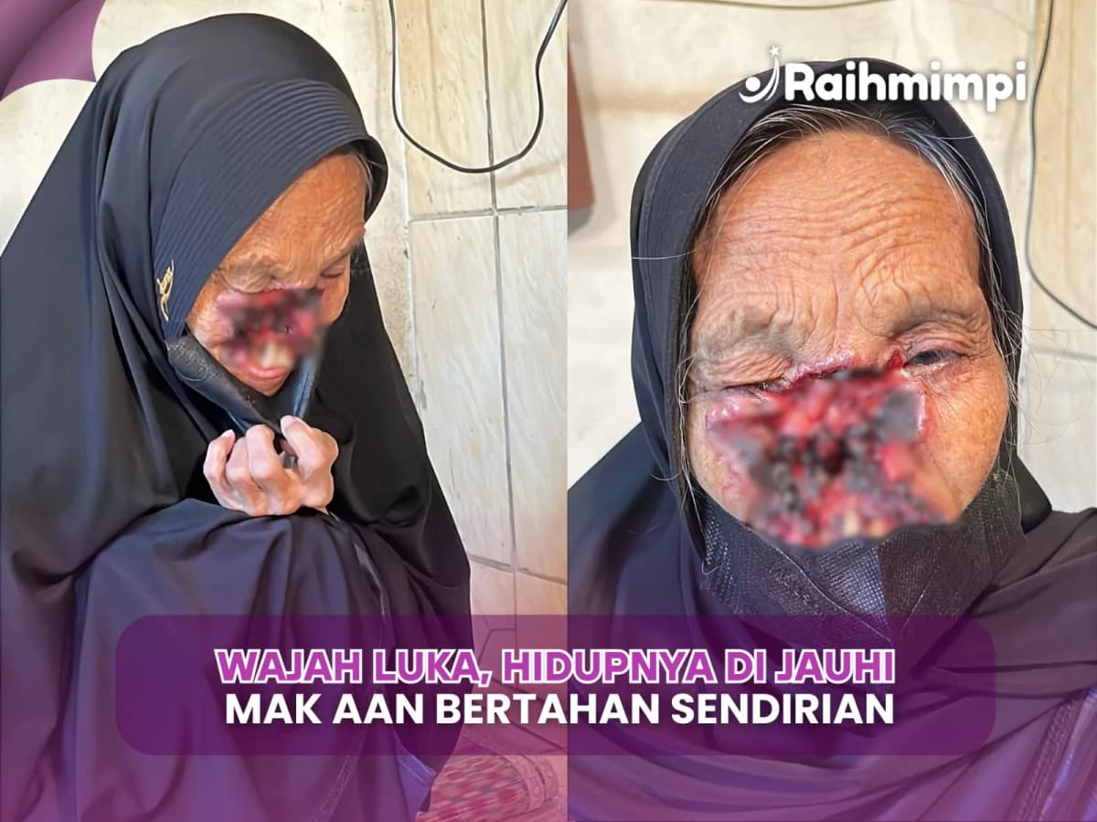 Perjuangan Mak Aan Dibalik Wajah Yang Terguras