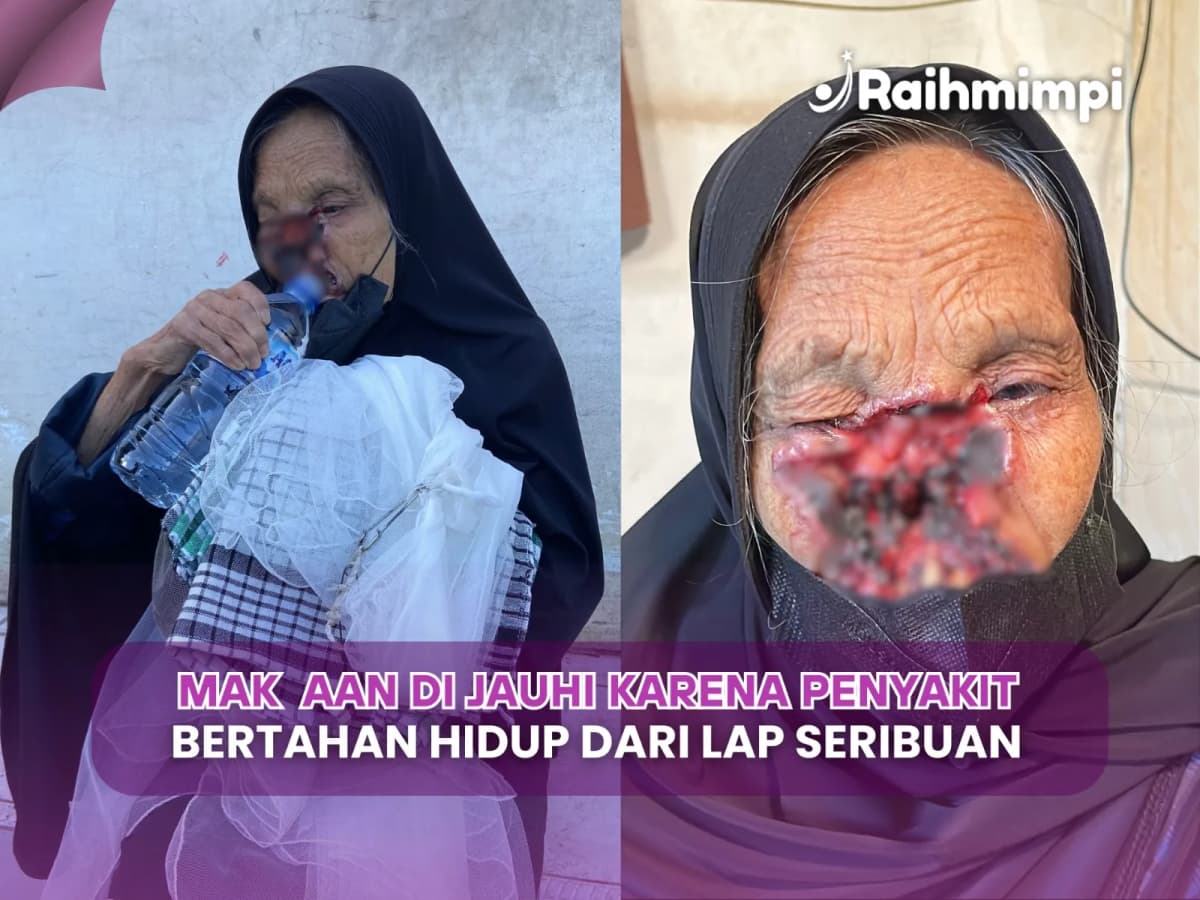 Perjuangan Mak Aan Dibalik Wajah Yang Terguras