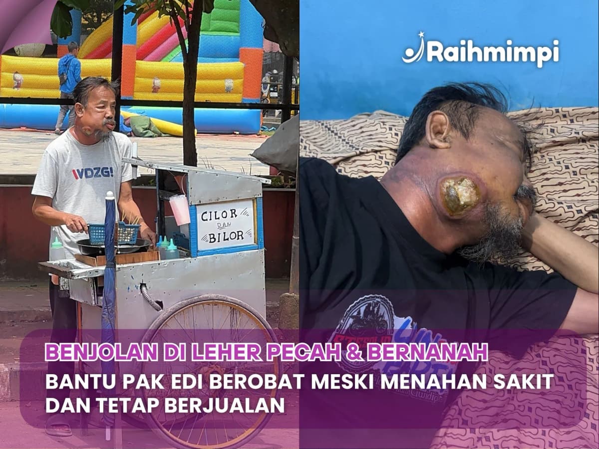 Foto campaign Benjolan Tumor Pecah, Tolong Bantu Pak Edi Berobat
