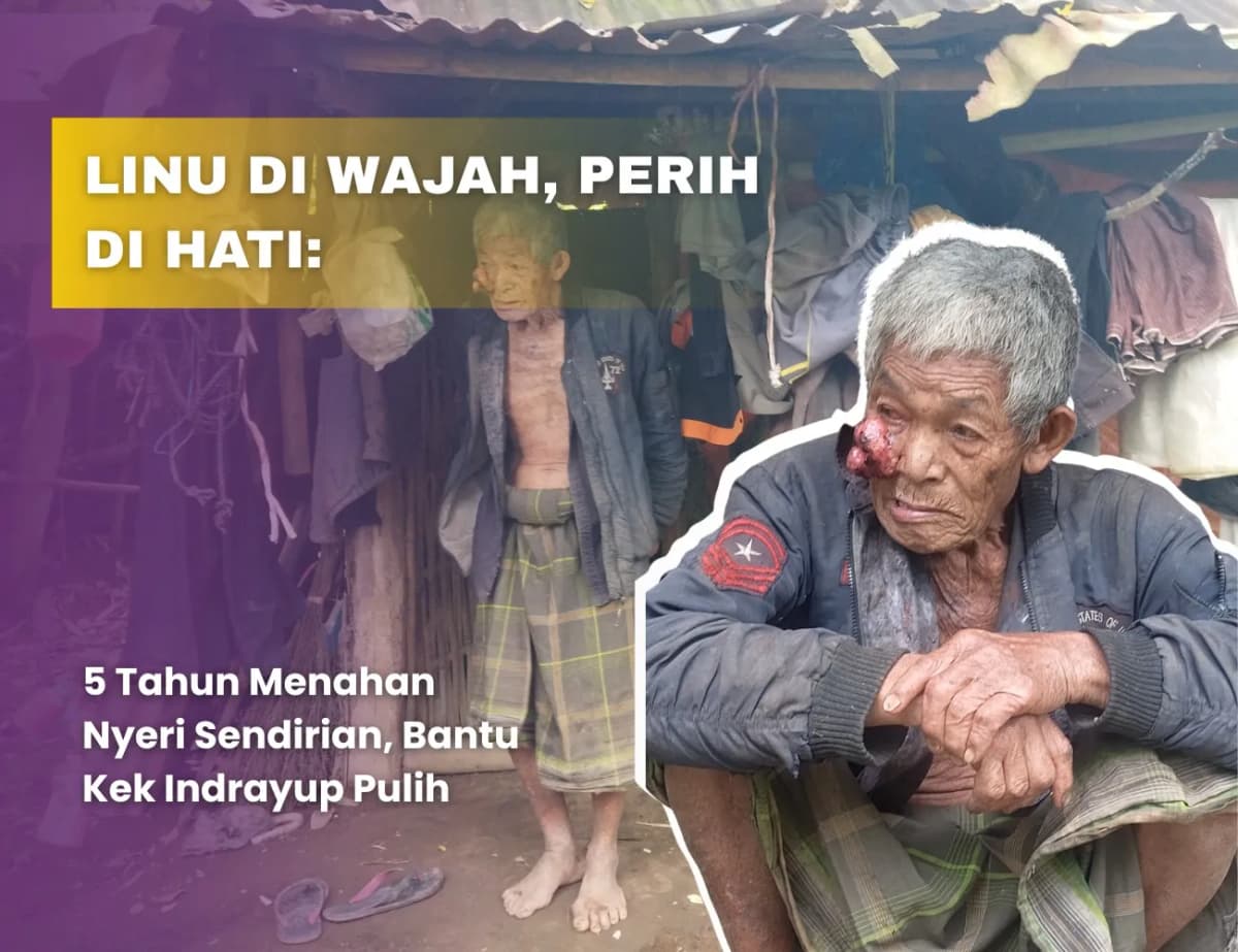 Derita Dalam Sunyi, Bantu Kakek Indrayup Bertahan