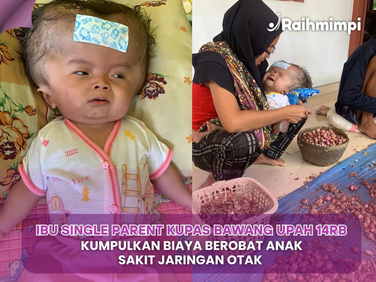 Foto campaign Otak Terancam Rusak Bawa Operasi Anak Ibu Single Parent