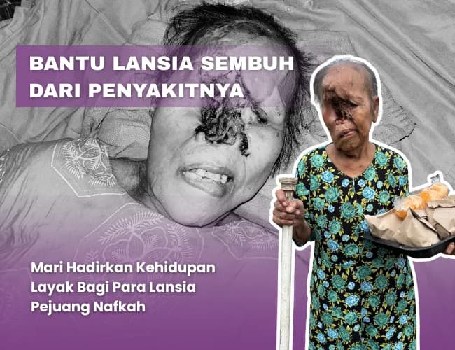 Bantu Lansia Pedagang Nasi Keliling Sembuh Dari Kanker Ganas