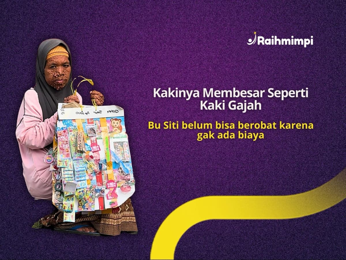 Foto campaign 80 Persen Tubuh Penuh Benjolan, Siti Dijauhi