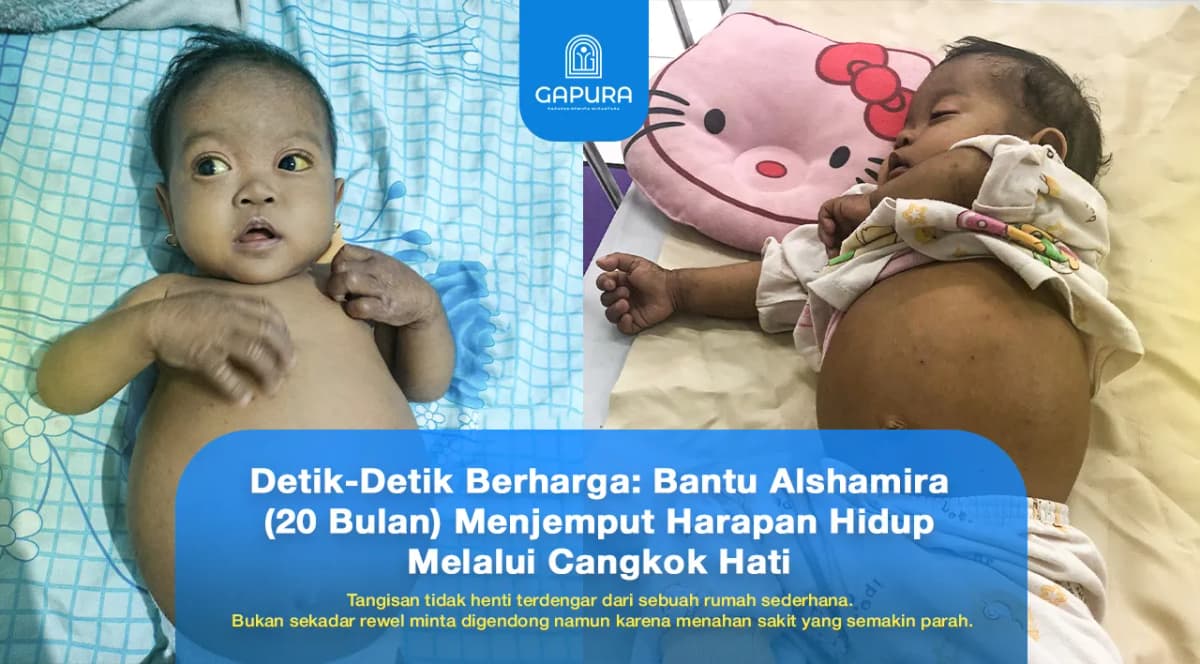 Darurat Medis Selamatkan Bayi Alshamira dari Gagal Hati Total