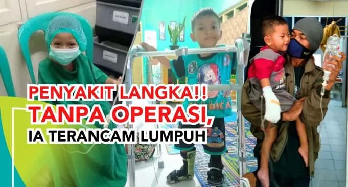 Mengalami Penyakit Langka Yandi Terancam Lumpuh