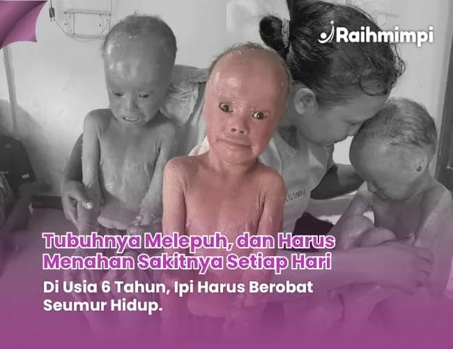 Foto campaign Sembuhkan Ipi Dari Sakit Kulit