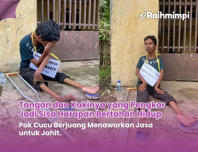 Kondisi Kaki dan Tangan Menekuk, Bantu Penjahit Difabel