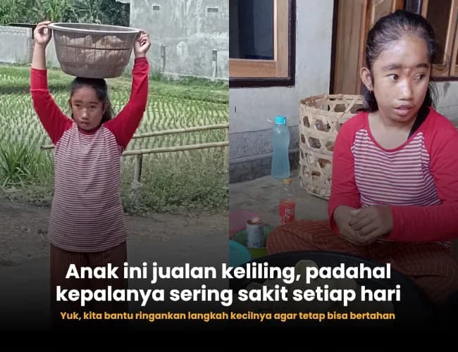 Foto campaign Dibully karena Hidrosefalus, Sopiana Tetap Jualan Demi Ibunya