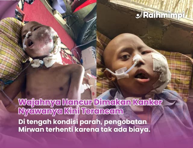 Jaga Harapan Selamatkan Para Pejuang Kesembuhan