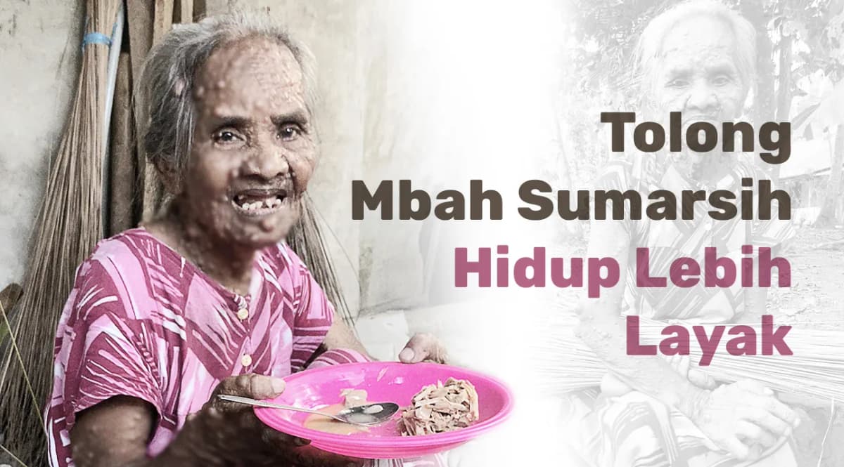 Foto campaign Bantu Lansia Sebatang Kara Pejuang Tumor Kulit Bertahan