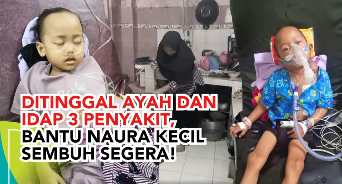 Ditinggal Ayah dan Idap Tiga Penyakit Naura Kecil Ingin Sembuh