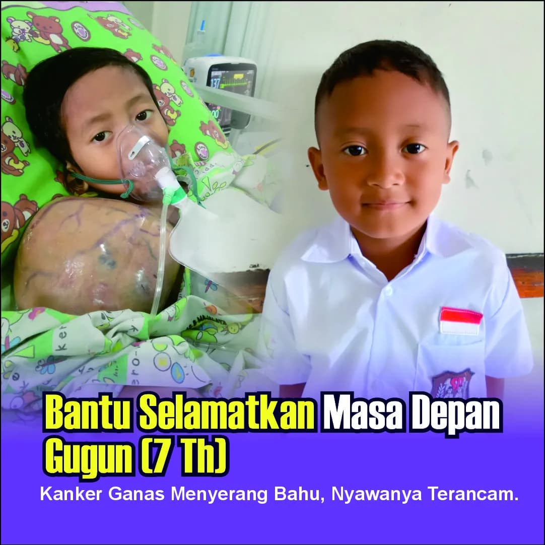 Foto campaign Putus Sekolah krn Kanker URGENT Sembuhkan Gugun