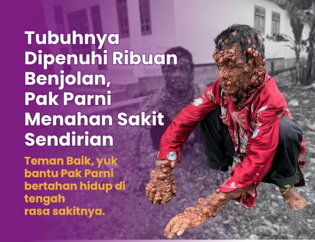 Foto campaign Ribuan Benjolan di Tubuh Perih Tolong Pak Parni