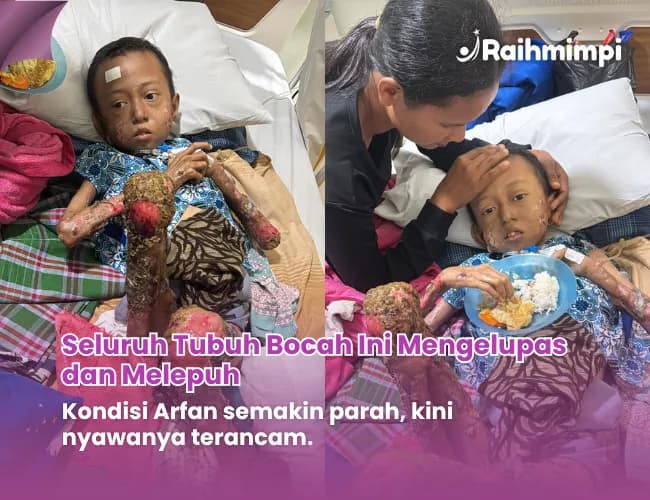 Foto campaign Suami Kabur Ibu Berjuang Sendiri Obati Anak Sakit Langka