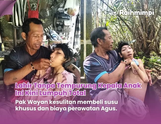 Foto campaign Bantu Pak Wayan Rawat Anak Dengan Kelainan