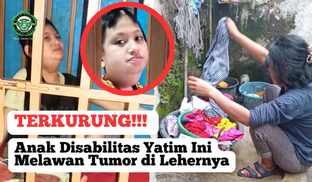 Foto campaign Perjuangan Ibu Rawat Anak Tumor dan Disabilitas