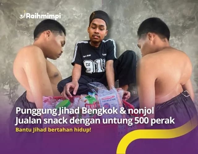 Foto campaign Yatim Berjuang Bertahan Hidup Meski Tubuhnya Tak Sempurna