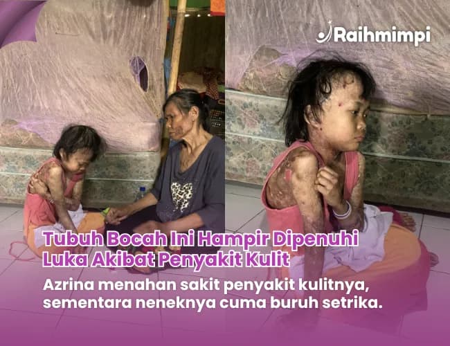 Foto campaign Mari Bantu Azrina Sembuh