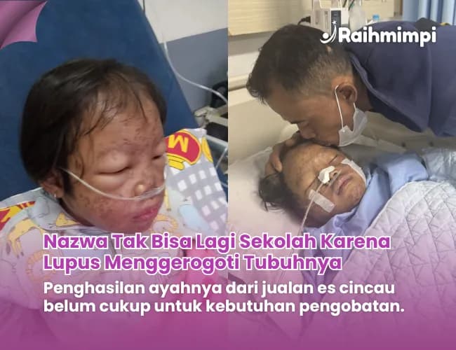Foto campaign Tolong Nazwa Kritis Berjuang Melawan Lupus