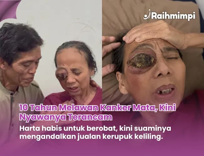 Foto campaign 10 Th Idap Kanker Mata Harta Habis Demi Pengobatan