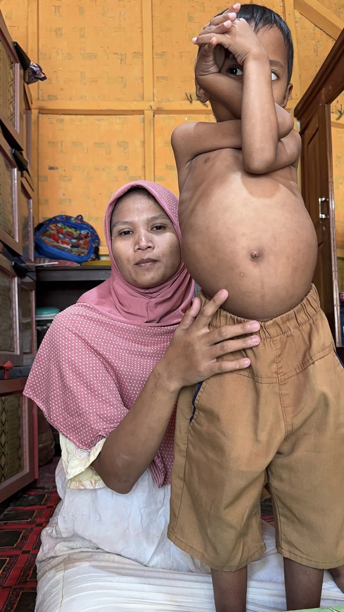 Foto campaign Perut Putra Terus Membesar Bantu Bocah 4 Tahun Ini Berobat
