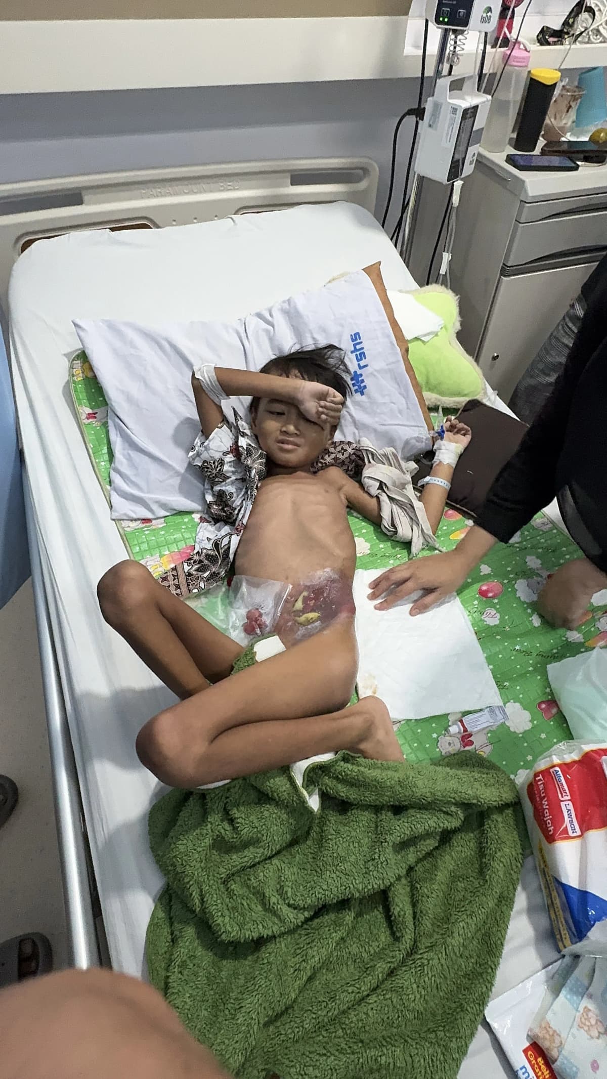 Foto campaign Idap Hirschsprung dari Lahir Rifki Kini Hanya Bisa Terbaring Lemah