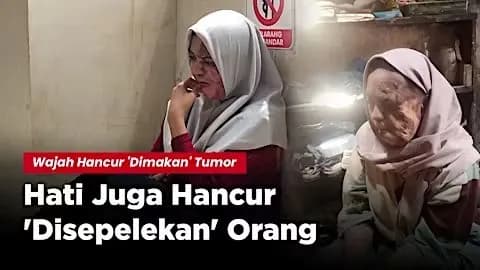 Foto campaign Wajah Hancur dimakan Tumor Heni harus Operasi