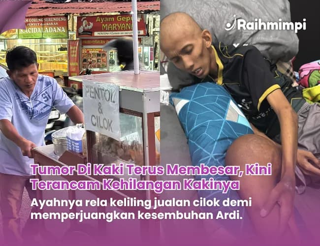 Foto campaign Terancam Diamputasi Selamatkan Anak Penjual Cilok Keliling