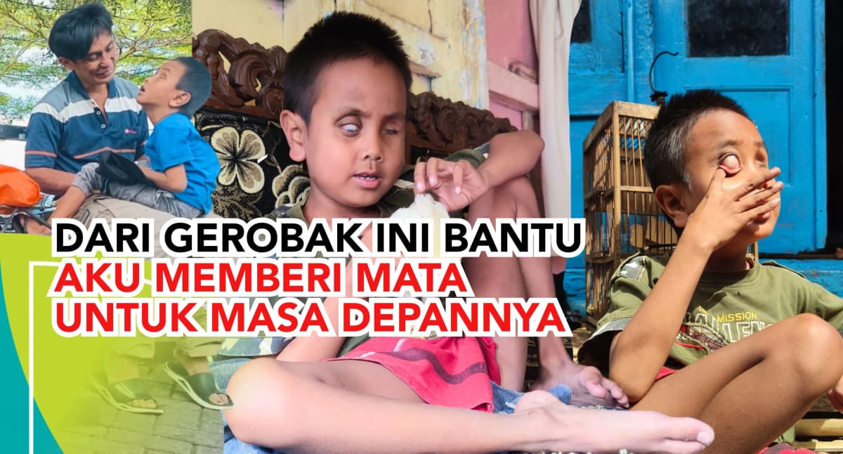 Foto campaign Bola Mata Untuk Givar Bantu Segera