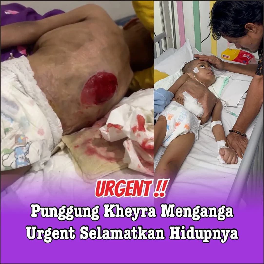 Foto campaign Punggung Kheyra Menganga Tubuhnya Tak Berdaya