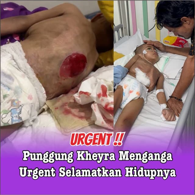 Punggung Kheyra Menganga Tubuhnya Tak Berdaya