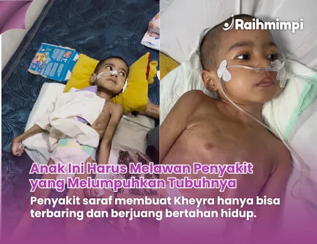 Foto campaign Punggung Kheyra Menganga Tubuhnya Tak Berdaya