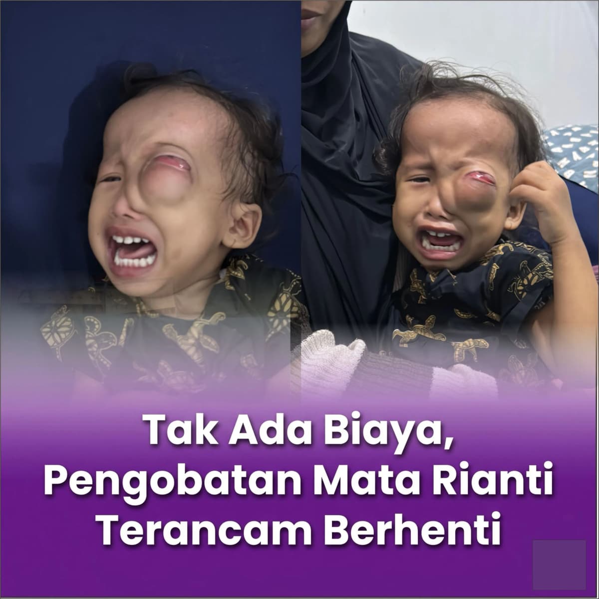 Foto campaign Tolong Anak Penjual Tisu Matanya Menonjol dan Tak Bisa Melihat