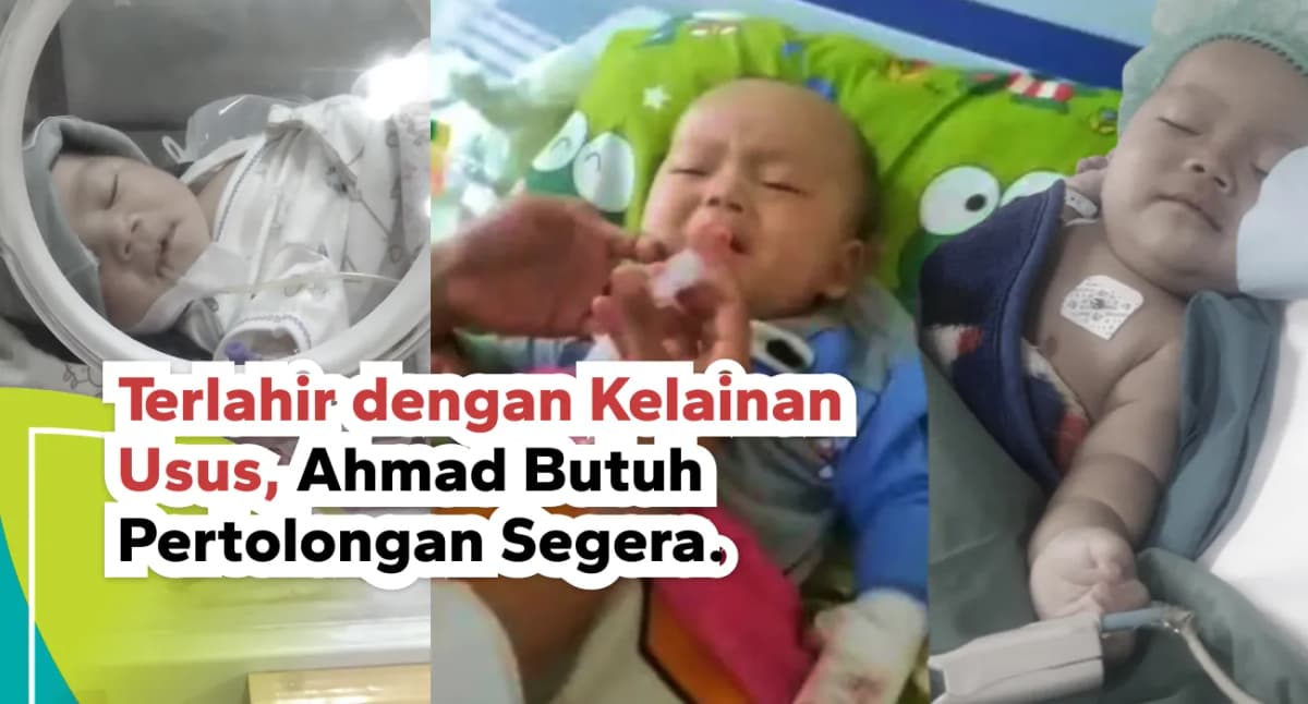 Foto campaign Terlahir Dengan Kelainan Usus Ahmad Butuh Pertolongan Segera