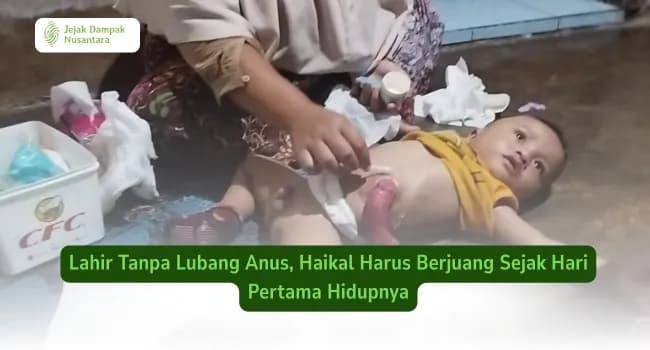 Foto campaign Ibunya Berjuang Sendirian Haikal Berjuang Melawan Kelainan Sejak Lahir