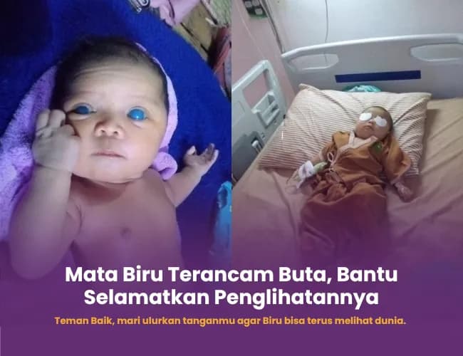 Foto campaign Mata terancam buta bantu biru sembuh