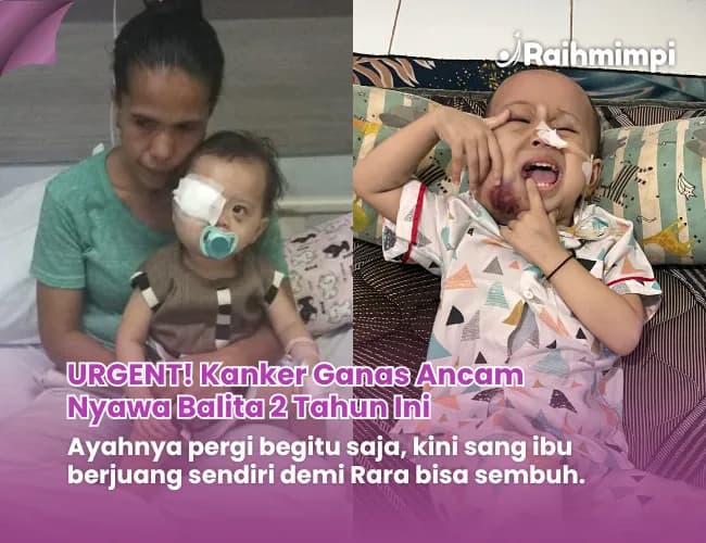 Foto campaign Dulu di Mata. Kini Kanker Menyerang Pipi Rara